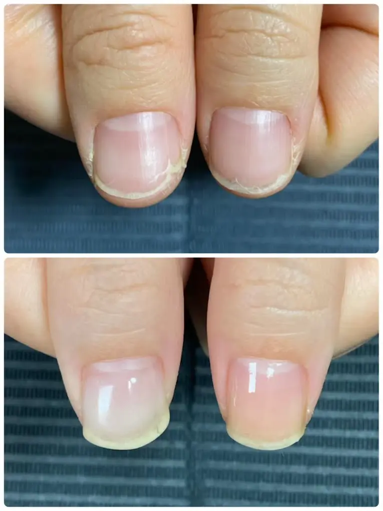 三国ヶ丘プライベートネイルサロン　Nail Salon RIELE　爪ケア