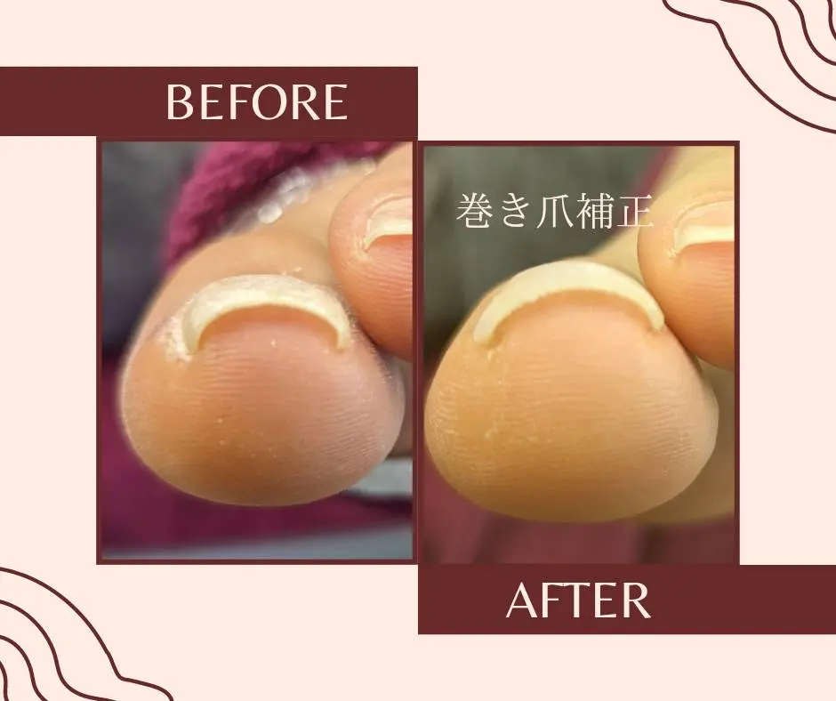 三国ヶ丘プライベートネイルサロン　Nail Salon RIELE　ビフォーアフター